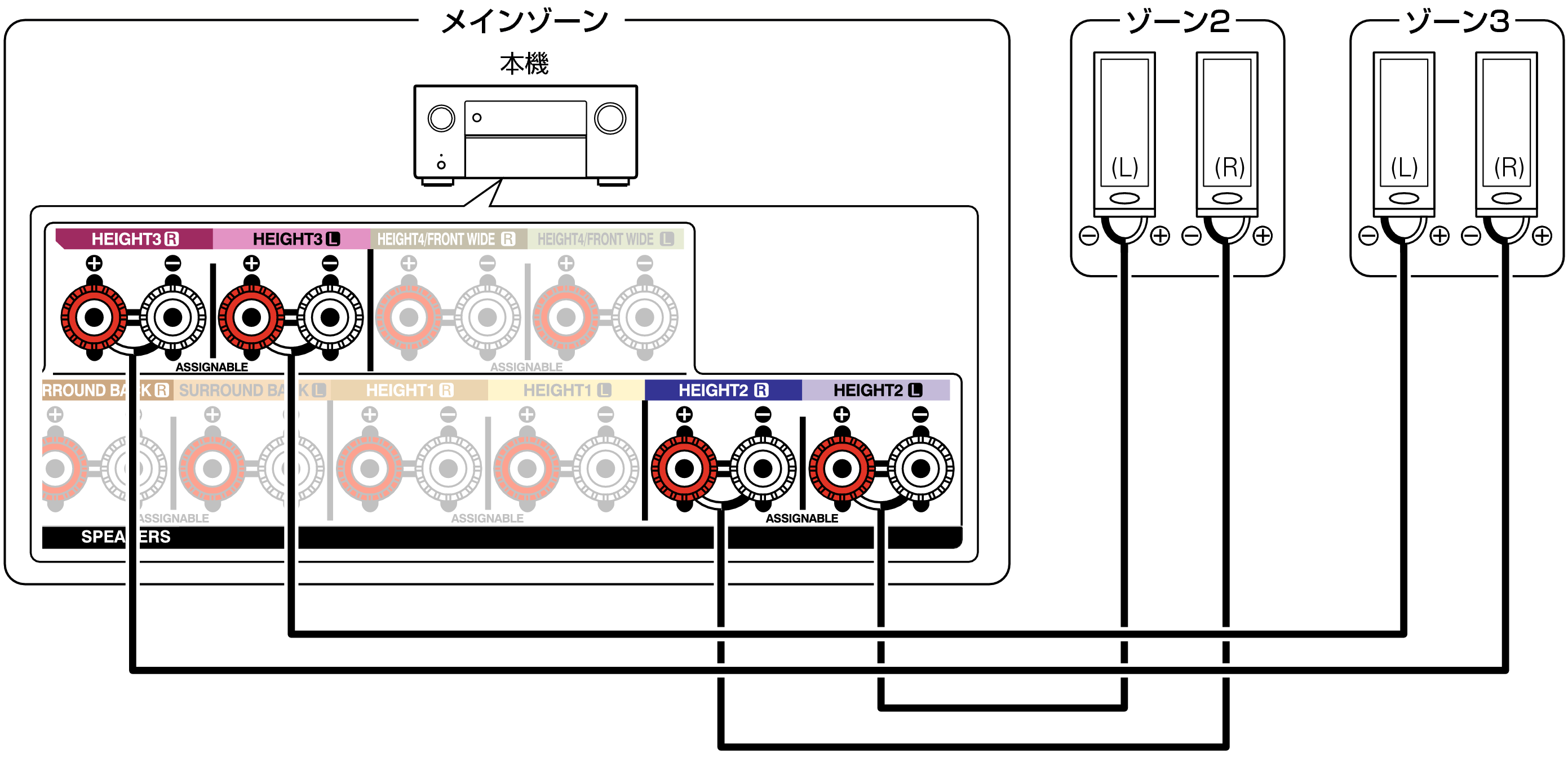 Pict ZONE Audio5  A10H
